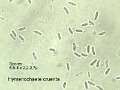 Hymenochaete cruenta-amf244-spores